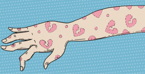 如何应对焦虑性皮疹